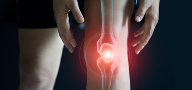 Joint Arthritis